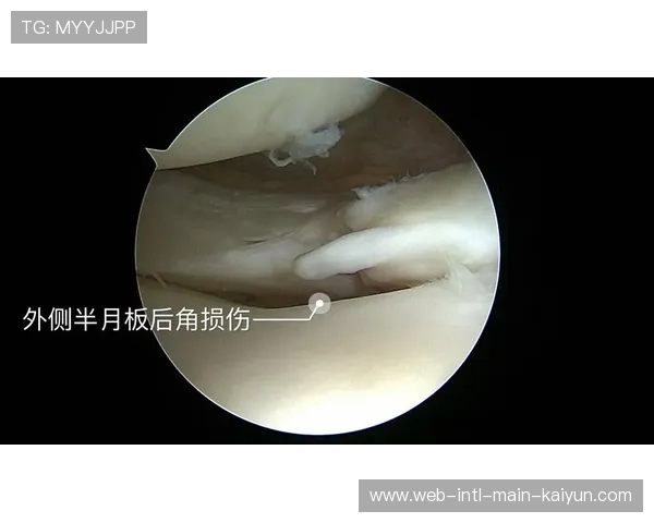 运动医学与智能硬件深度交叉 催生出针对高原环境的专项防护方案